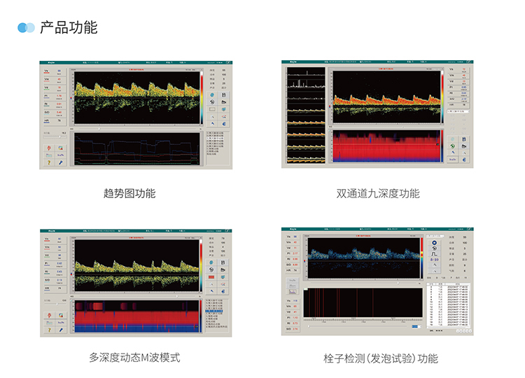 便攜式超聲經顱多普勒血流分析儀